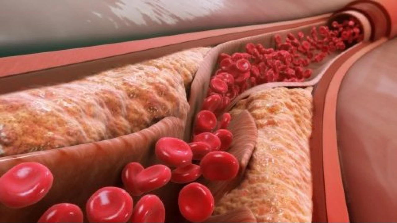 Vücuttaki Kalsiyumun Aşırı Azalmasının Çok Sakıncalı