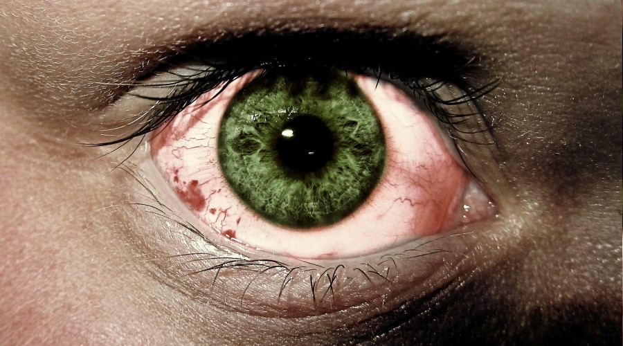 Yaz aylarında bu enfeksiyonlara dikkat!