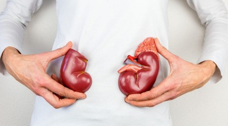 Böbrek taşına ‘kapalı’ tedavi