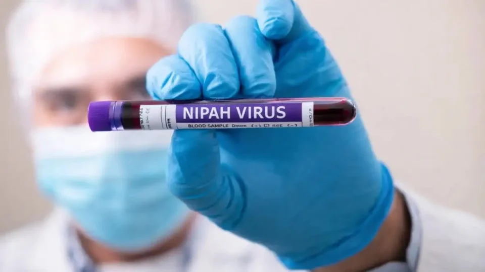 Nipah virüsü Türkiye'ye gelir mi?