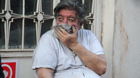 Ocakta unuttuğu patates nedeniyle ölümden döndü