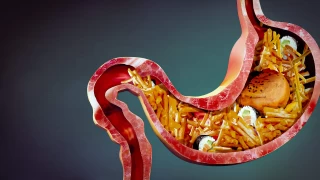 Akşam Yemeğinde Yanlış Seçimler Mideyi Yakıyor