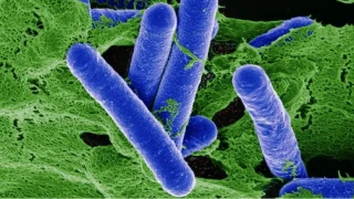 Botulizm Tehlikesi Artık Soframızda