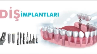 mplant tedavisi hakknda doru sanlan yanllar