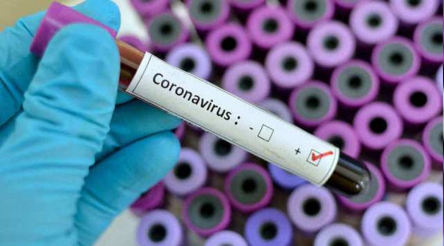 Rus virüs bilimciden kritik açıklama