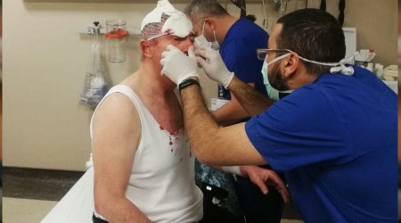 Siyaseti geren silahlı ve sopalı saldırılar... Soylu'ya görevini yap çağrısı