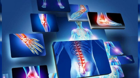 Bel ağrılarınız iltihaplı romatizma olabilir