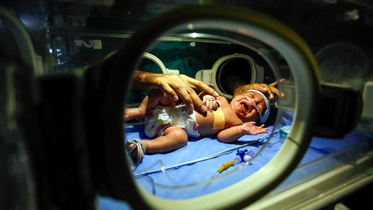 Hangi bebekler yoğun bakım ünitesine alınır?