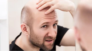 Şekerli İçecekler Saçları Sessizce Zayıflatıyor