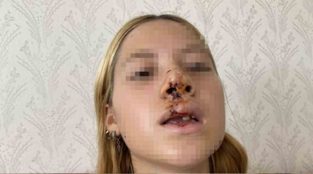 Türkiye'nin konuştuğu olayın kahramanı ilk kez anlattı