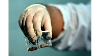 Türkiye'de böbrek taşı yaygın çünkü...