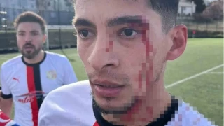 Bilecik'teki maçta 3 futbolcu hastanelik oldu