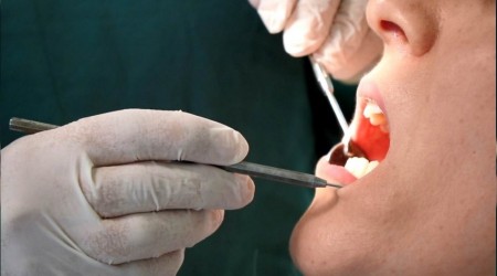 Kırılan dolgular ihmale gelmez