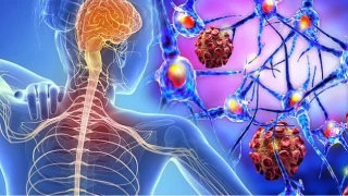 Plastik Kirliliği MS Riskinde İki Kat Artış Oluşturdu